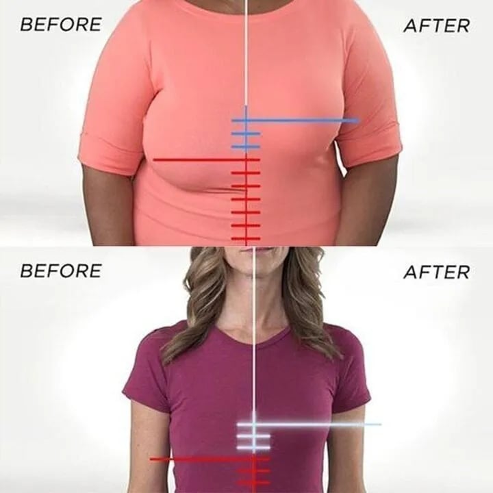 Lyro™ | SoftSupport Bra